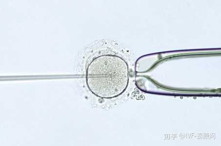 外地人在北京怀孕后必须建档才能做产检吗？,北京海军总医院做一次三代试管