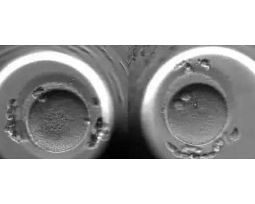 打了达菲林15打达菲林后可不可以运动？~有偿捐卵