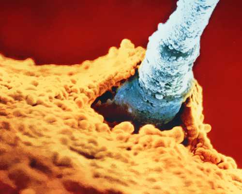 北京助孕有那些医院,北京户籍人口出生数创10年新低：人少了，还需要“鸡娃”