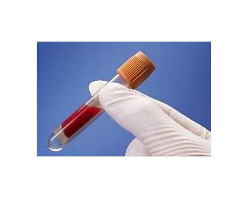 反复流产后试管成功率大吗,反复流产能做试管婴儿吗