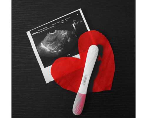 ?多囊样卵巢综合症是什么？~助孕公司地址