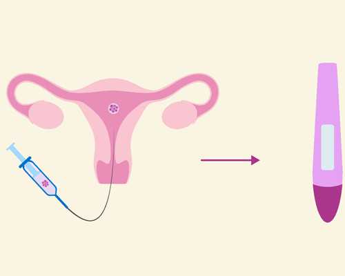 试管不着床与生化哪个更可怕