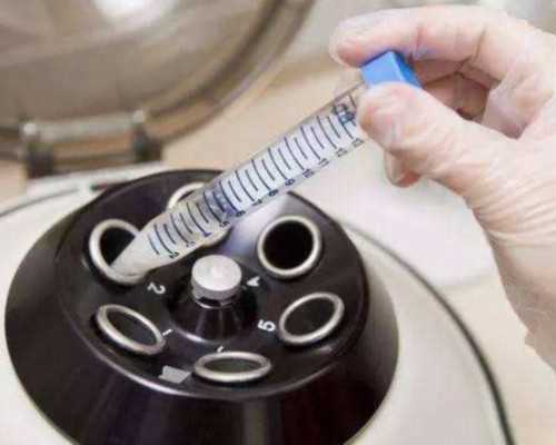 北京哪有供卵中心,2024北京协和医院试管价格