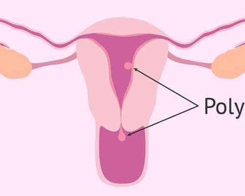 北京代生怀孕机构|北京朝阳医院做供精试管费用是多少？北京朝阳医院供精试