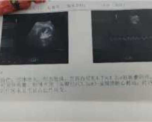 北京代怀供卵机构|北京供卵试管医院有哪几家?