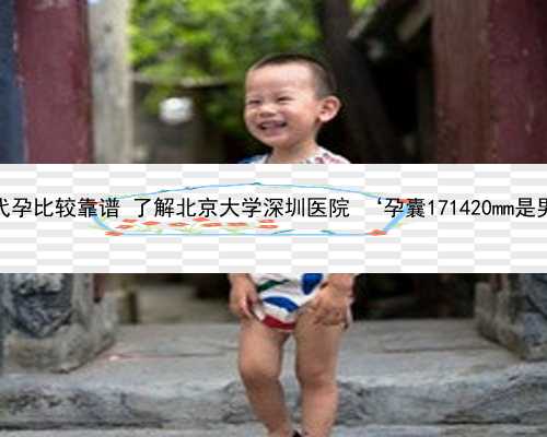 北京那里代孕比较靠谱 了解北京大学深圳医院 ‘孕囊171420mm是男孩女孩’